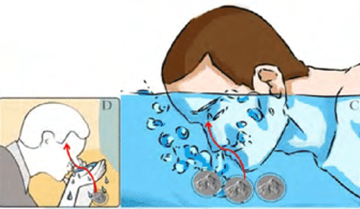 食脑虫|“食脑虫”再现美国，致死率高达97％，但这还不是最可怕的