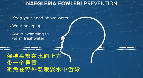 食脑虫|“食脑虫”再现美国，致死率高达97％，但这还不是最可怕的