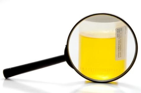 帝国理工学院|“尿液指纹”看出你的饮食好坏