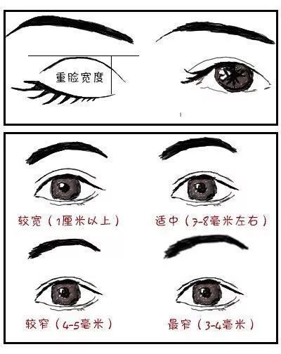 双眼皮形状不满意 如何调整 腾讯新闻