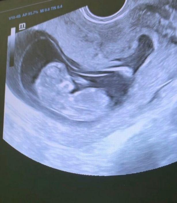 玛丽娜·巴尔马舍娃|俄罗斯女子和相差15岁的继子结婚，网友：我们反对这门亲事