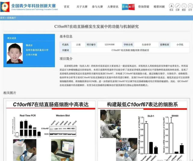 6年级小学生写出晦涩医学论文 理科生炸了 完全看不懂 陈灵石 论文 医学 理科 小学生 青少年科技创新大赛