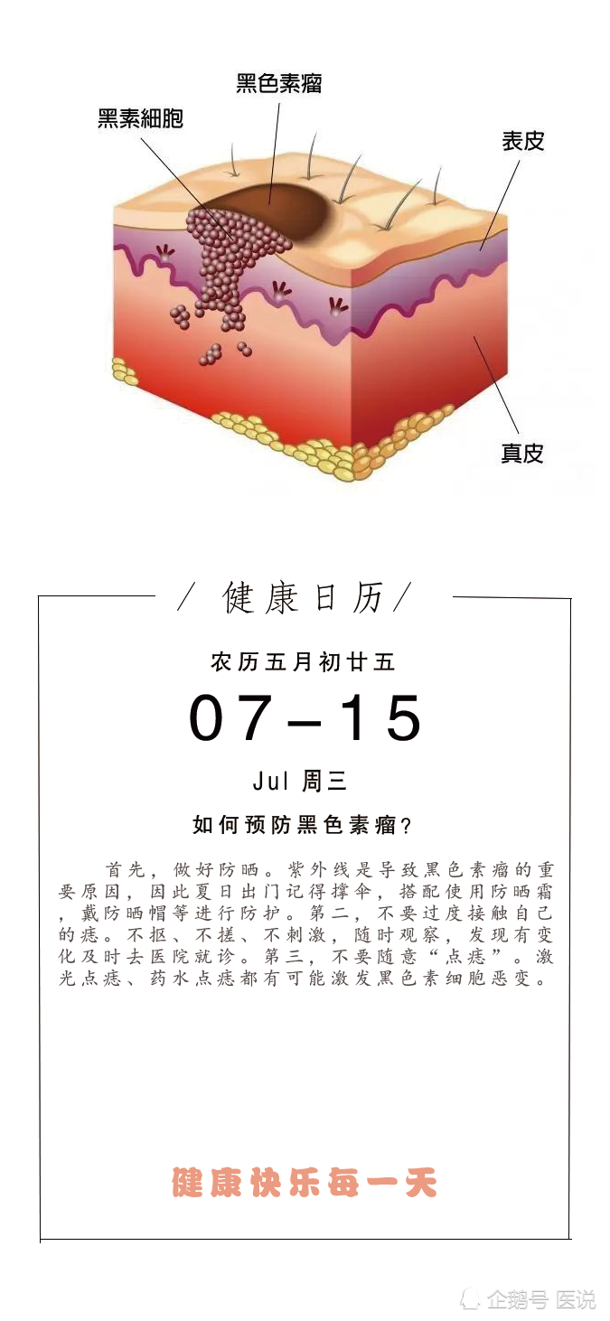 黑色素瘤|如何预防黑色素瘤？