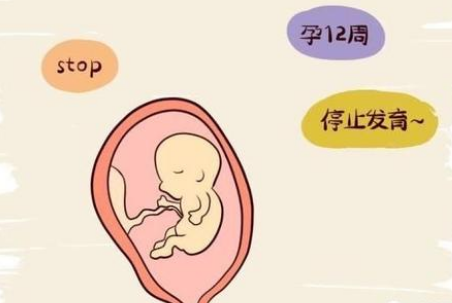 胎停育会不会有前兆 这几个信号 预示着胎停的发生 别大意了 腾讯网