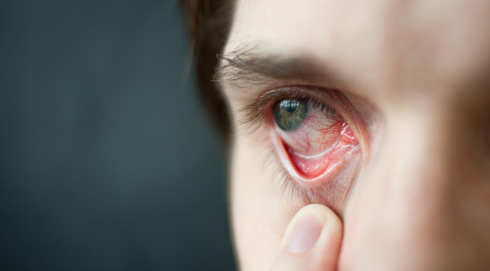 白内障|白内障逐渐年轻化！这3个原因，大多数人避无可避