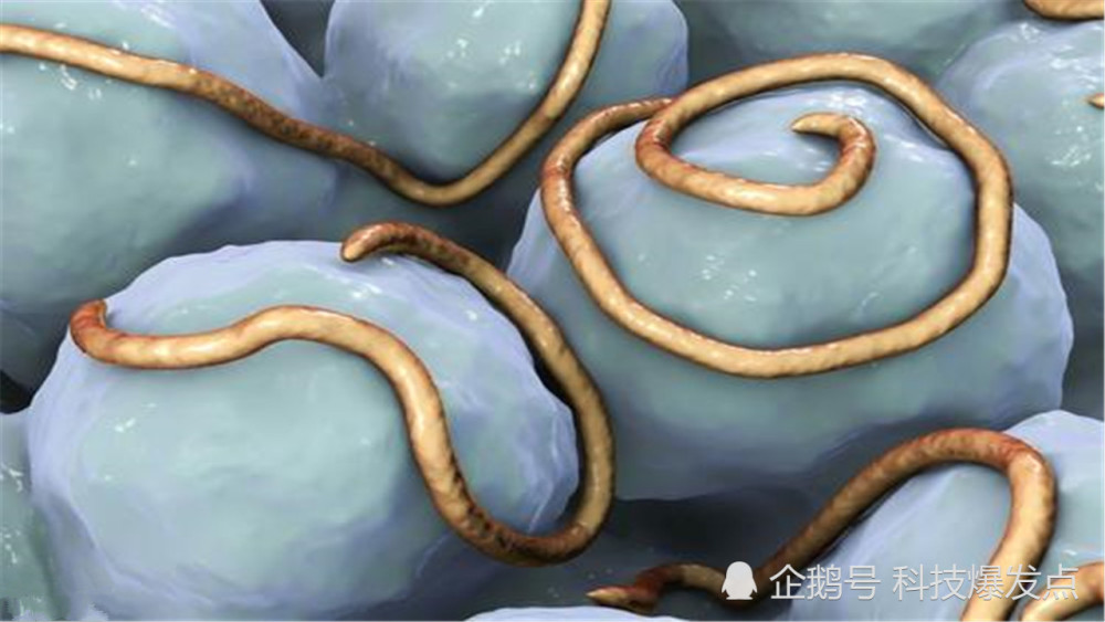 美国再现食脑虫寻找食物致人死亡截止2019年仅4名幸存者