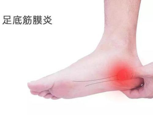 脚跟出现疼痛是什么原因而导致的应该怎么治疗