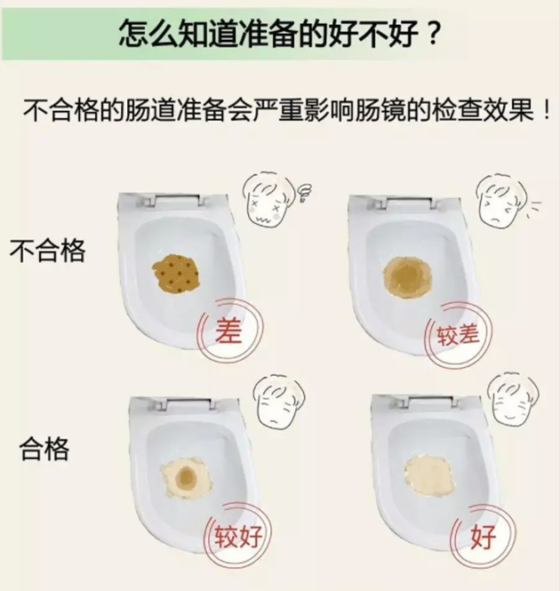 结肠镜检查攻略这些要早点知道