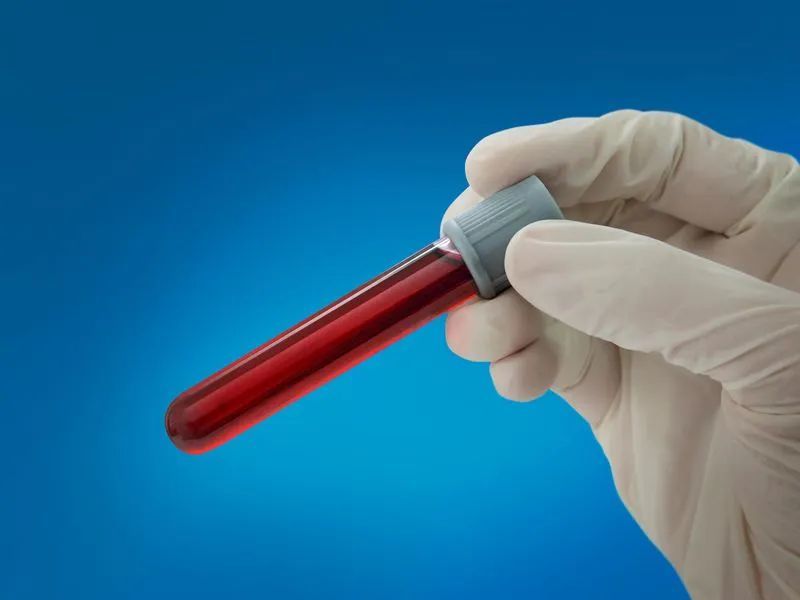 癌症|“抽一管血”，就能发现你以后是否会患癌症？