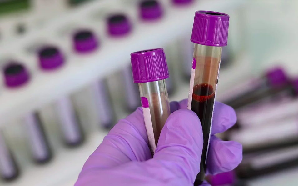 癌症|“抽一管血”，就能发现你以后是否会患癌症？