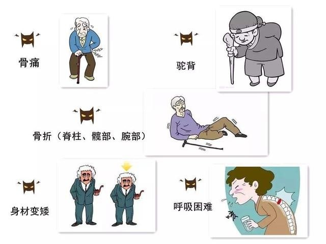 骨质疏松症易"招惹"!