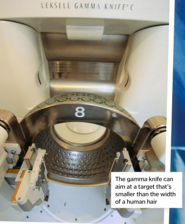 伽玛刀|一项新技术——伽玛刀