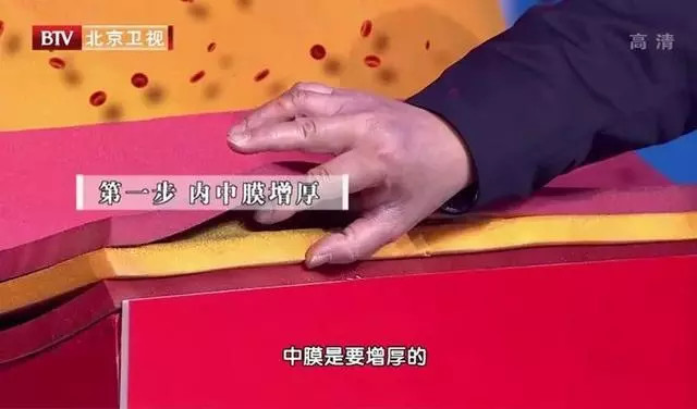 心肌梗塞|三年前体检正常，三年后心梗死亡！元凶竟是这道家常菜！