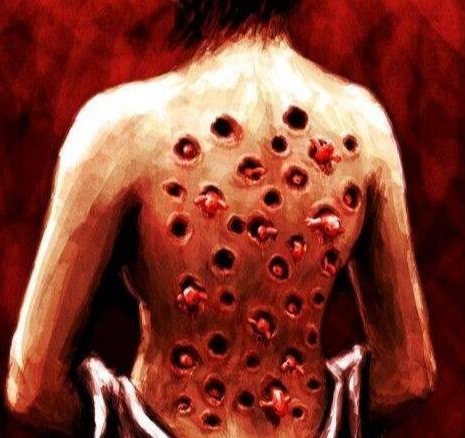 十宗罪玉米男孩真实事件,密集恐惧症人群慎入_腾讯新闻