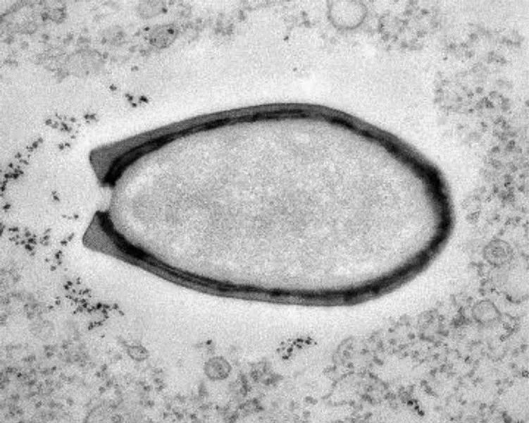 北极地区|北极附近森林大火肆虐！38度高温比热带还热！