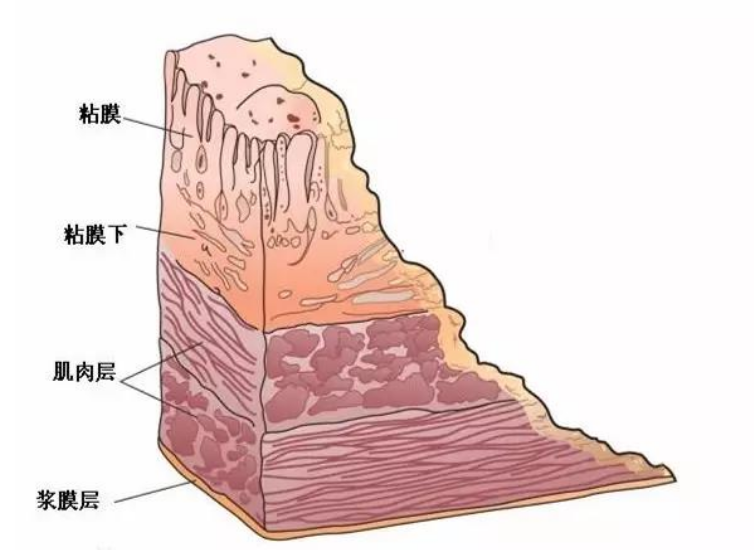 吃播的胃和普通人有啥区别?营养专家:他们这块"肌肉"比你更厚