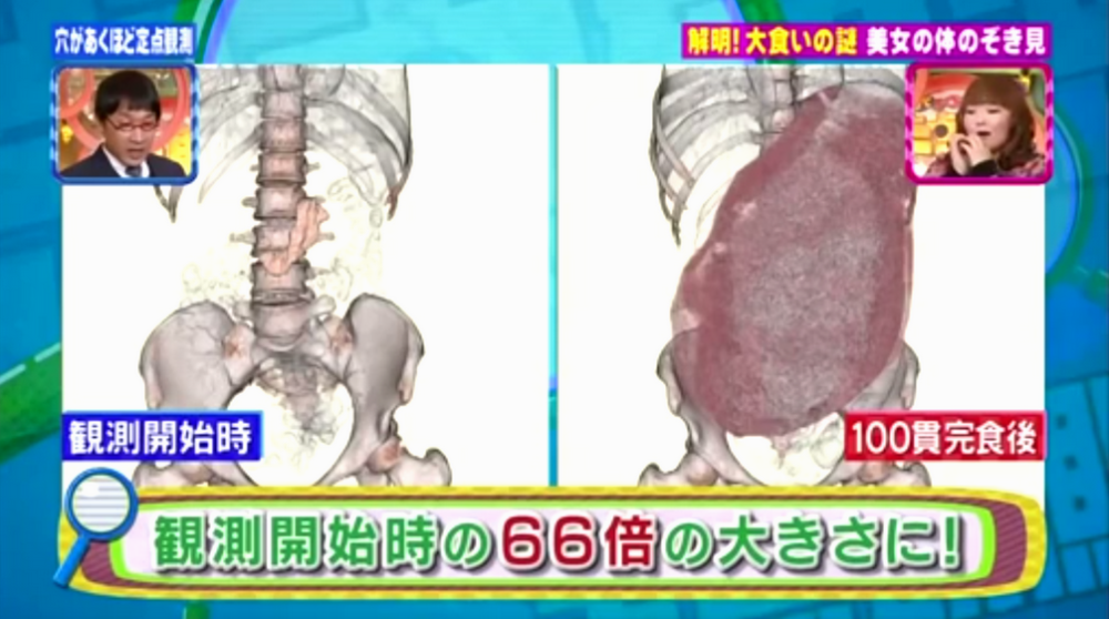 吃播的胃和普通人有啥区别 营养专家 他们这块 肌肉 比你更厚 腾讯新闻