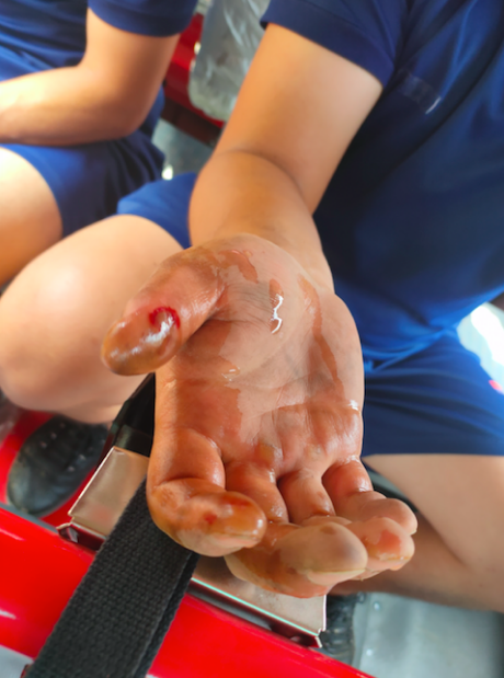 消防员|面包车突然爆胎！“蓝朋友”出手相助，大拇指被挤出血泡