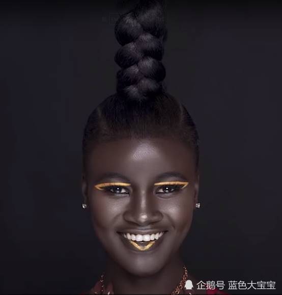 世界上5位拥有奇特皮肤的人类