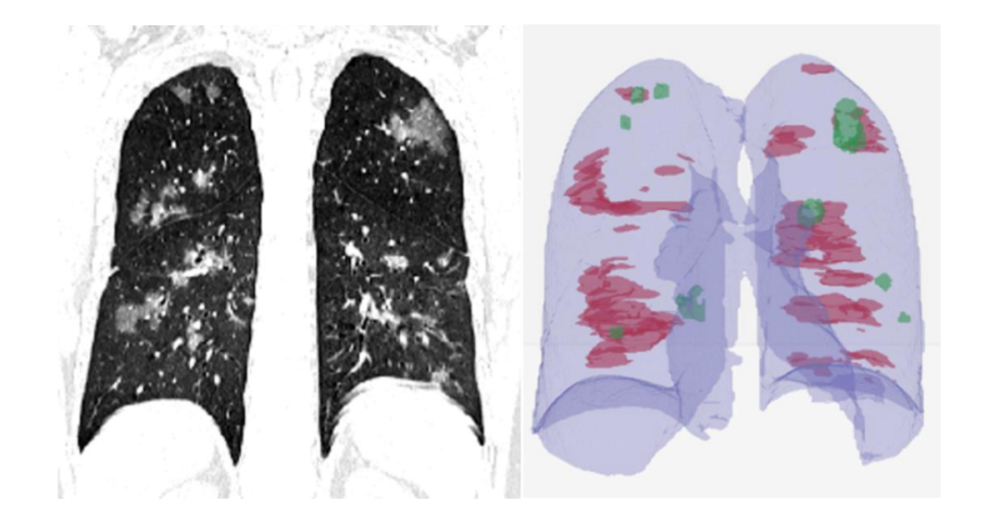 人工智能|人工智能改变世界了吗？医疗AI的困境与抉择