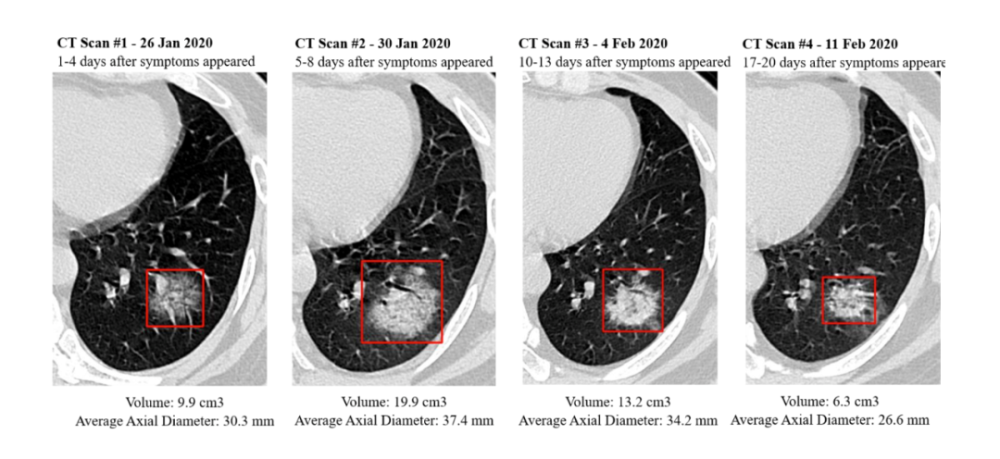 人工智能|人工智能改变世界了吗？医疗AI的困境与抉择