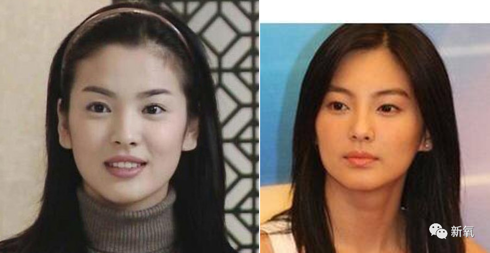 张雨绮|为什么张雨绮眼球秃、山根肿，还被称为惊艳美人绝世尤物？