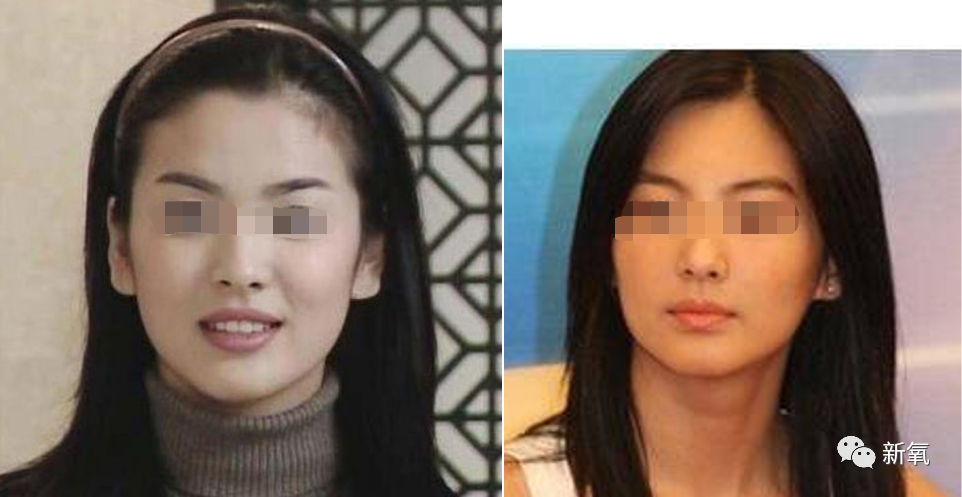 张雨绮|为什么张雨绮眼球秃、山根肿，还被称为惊艳美人绝世尤物？