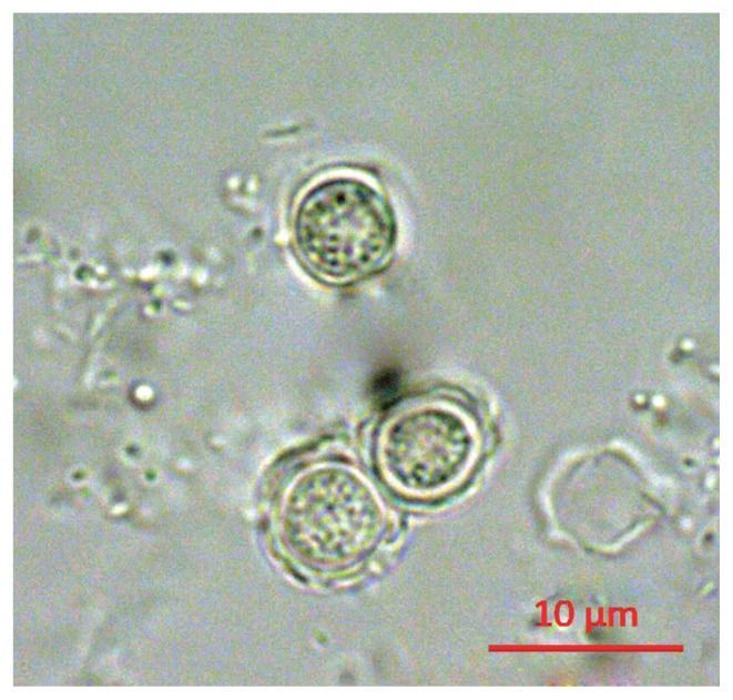 美国佛罗里达州|美国佛罗里达州惊现“食脑虫”，“食脑虫”会不会出现在中国的自来水里？
