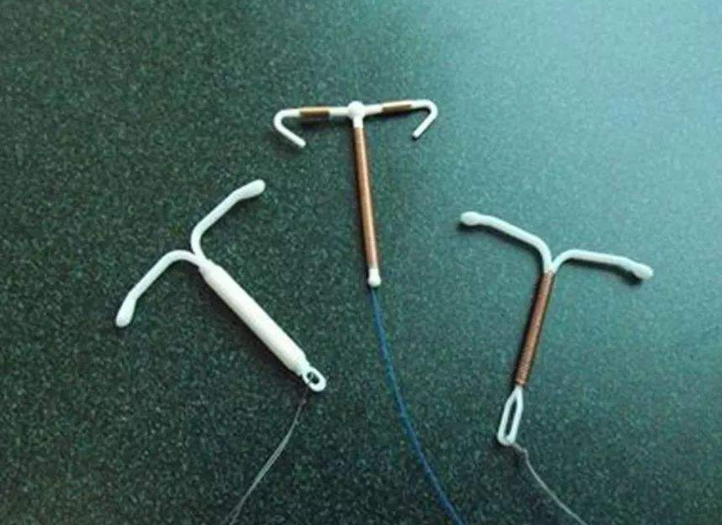 带了30年的节育环,取出后让人唏嘘,这些年身体经历了什么?