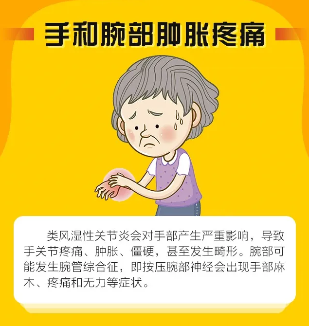 類風溼還是關節勞損?別傻傻分不清!7個先兆讓你一眼看破_騰訊新聞