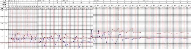 大动脉炎|中老年女性，发热伴头痛、乏力、消瘦，你知道病因是什么吗？