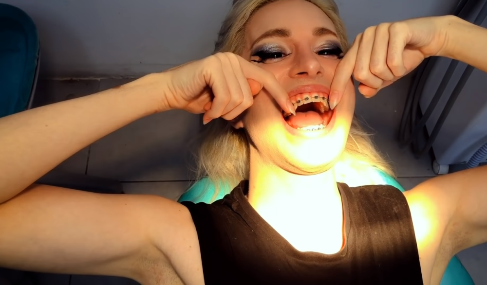 路易斯|男子从小受同学欺凌一心想变成精灵，如今已做了32次整容手术