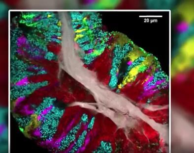 蠕虫|我们最古老的祖先有可能是这种你没见过的蠕虫小动物