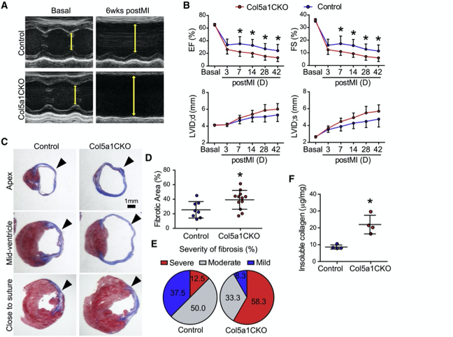 急性心肌梗死|治疗心肌梗死，胶原蛋白V或是救星！