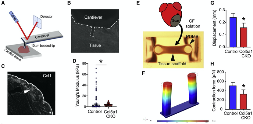 急性心肌梗死|治疗心肌梗死，胶原蛋白V或是救星！