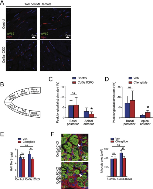 急性心肌梗死|治疗心肌梗死，胶原蛋白V或是救星！