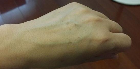 老年斑的元凶是它们医生教你4种办法给皮肤做次大扫除