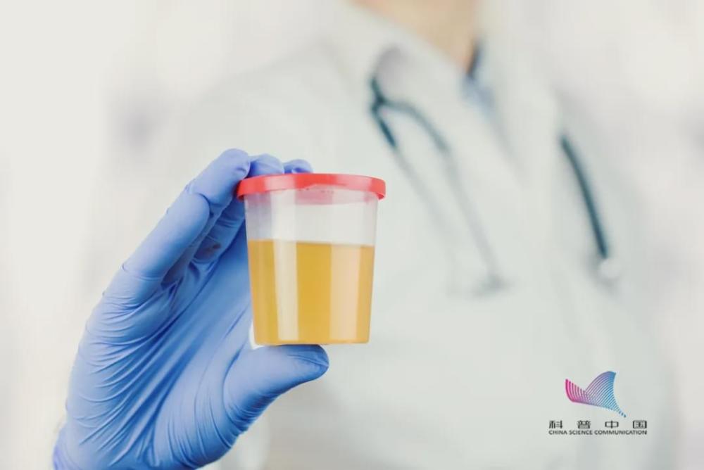 尿液|注意！上完厕所最好看一眼，尿液出现这几种颜色要当心了！