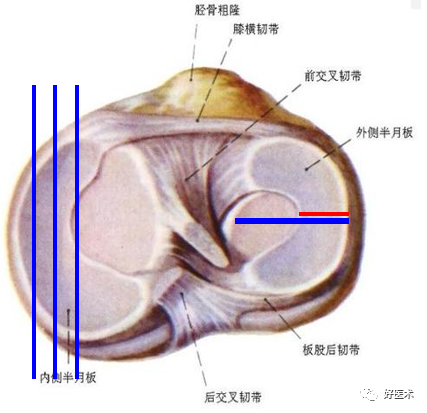 层层深入图文详解半月板mri解剖诊断 必备收藏贴 腾讯新闻