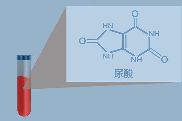 长期尿酸高，和哪些祸首有关？降尿酸，该怎么做？