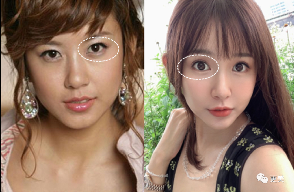 陈赫|曾美过杨幂，如今“馒化”成张大奕2.0，陈赫老婆整到认不出