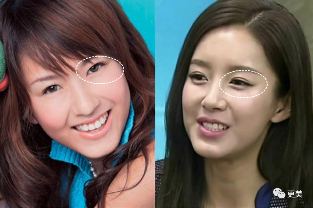 陈赫|曾美过杨幂，如今“馒化”成张大奕2.0，陈赫老婆整到认不出