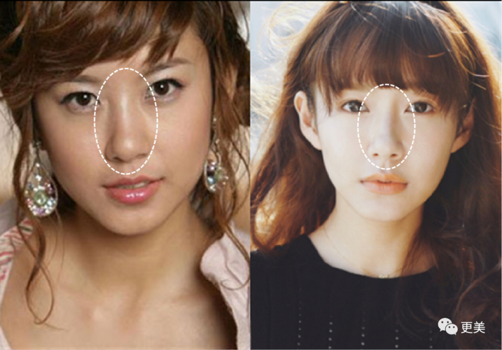 陈赫|曾美过杨幂，如今“馒化”成张大奕2.0，陈赫老婆整到认不出