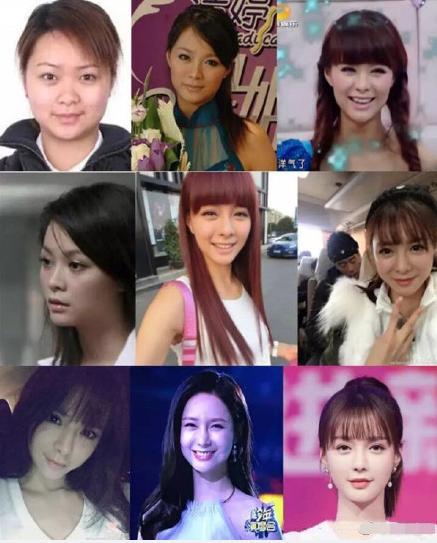 沈梦辰|沈梦辰早年旧照被扒，脸宽眼小鼻头硕大，与如今精致长相判若两人