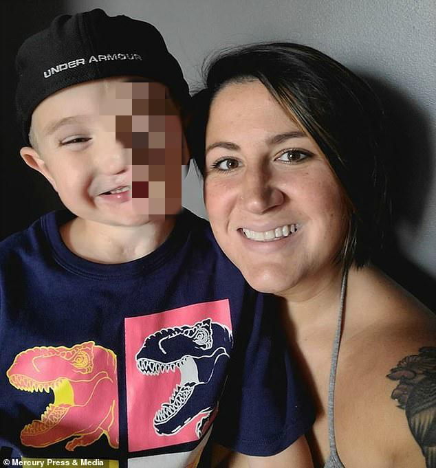 瑞德|美7岁男童遭2只恶犬疯狂撕咬丧失脸颊，做50次手术仍被骂怪物