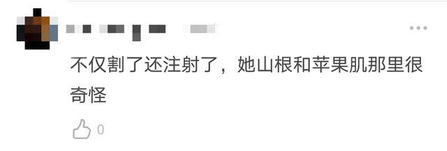 张雨绮|人红是非多！张雨绮旧照曝光被质疑整容，与如今美艳形象判若两人