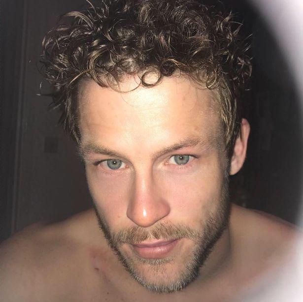 英国_社会|英国小夫妻原本郎才女貌，结果想不开吸毒，如今容貌大变惨不忍睹