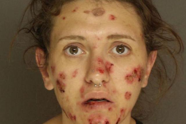 英国_社会|英国小夫妻原本郎才女貌，结果想不开吸毒，如今容貌大变惨不忍睹