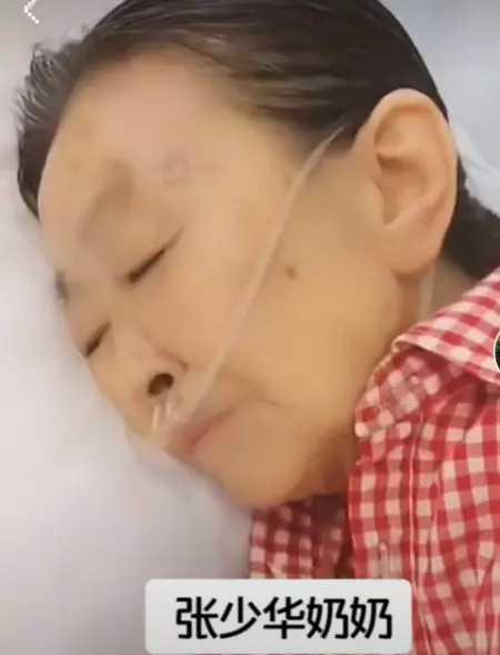 张少华|83岁张少华又住院！插呼吸管无人照顾晚年凄凉，带人抄家仍被骂