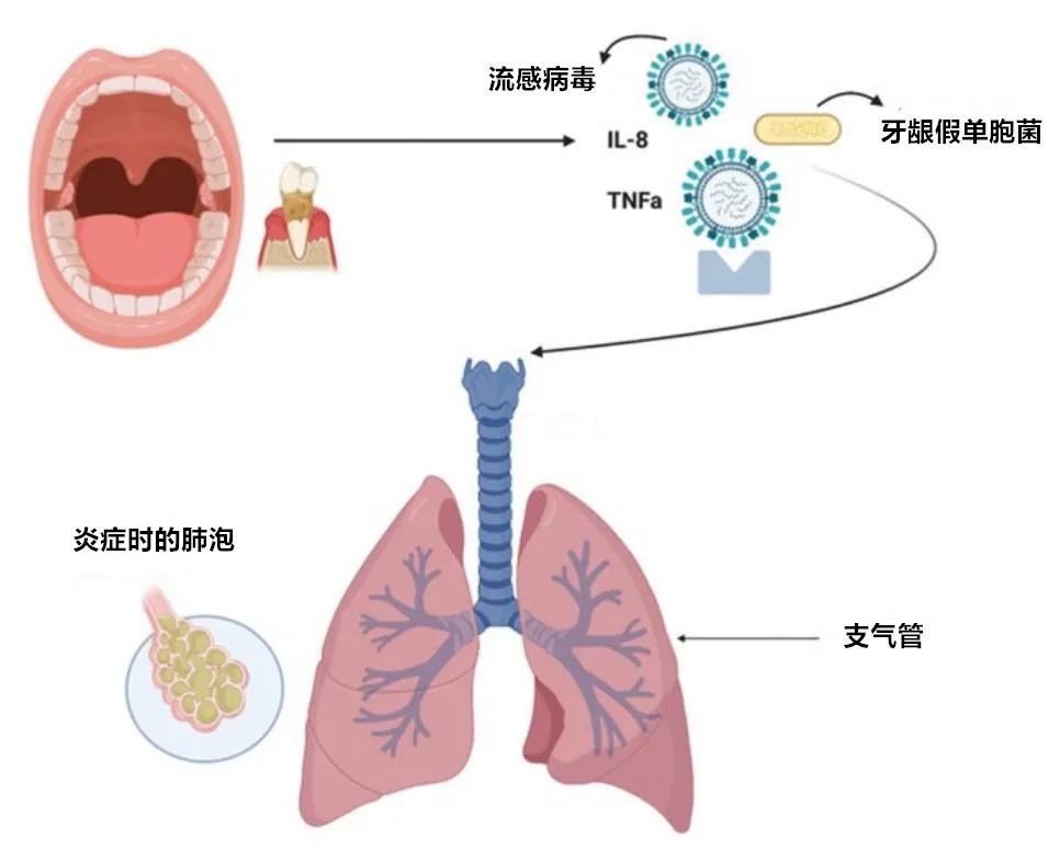 因此,不良的口腔卫生会增加病菌侵入肺部的风险,增加呼吸道感染和感染